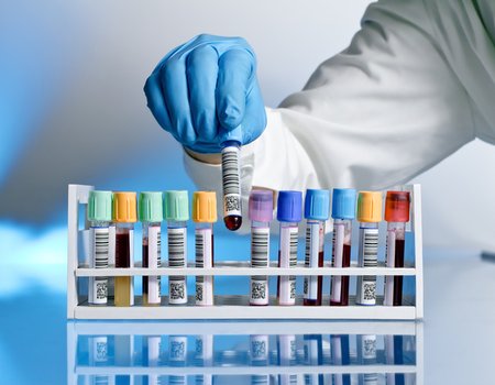 thinkstockphotos177440807_1195114